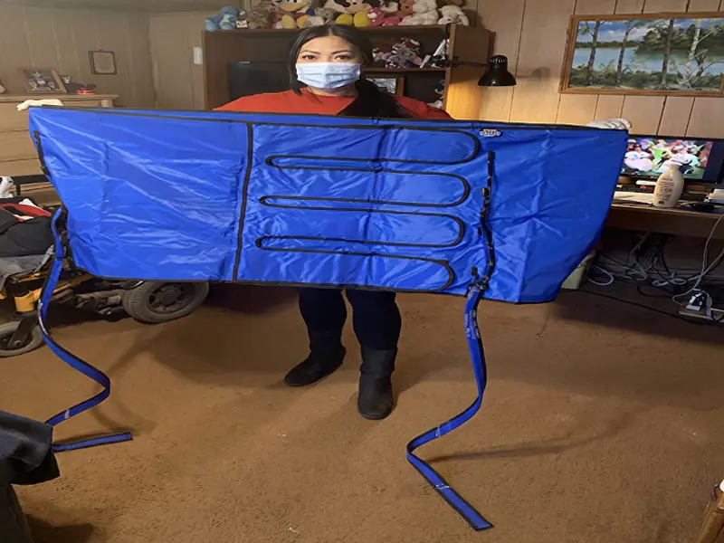 Custom compression garment fitting for lymphedema patient