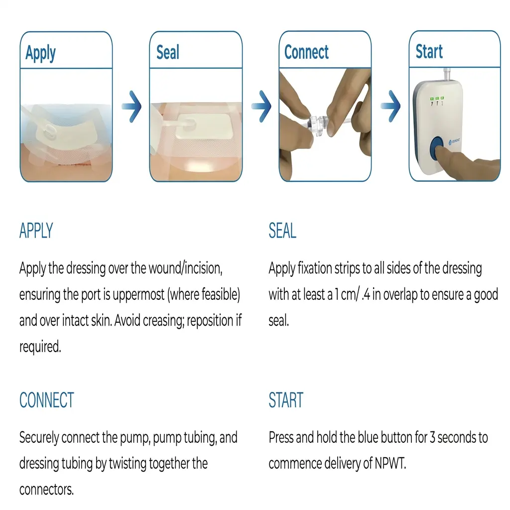 Wound Vac Image 2